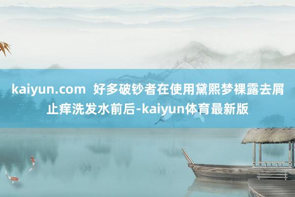 kaiyun.com  好多破钞者在使用黛熙梦裸露去屑止痒洗发水前后-kaiyun体育最新版